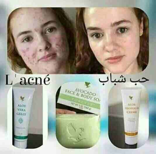 مجموعة حب الشباب من فوريفر الأمريكية
√ يساعد على التخلص من الحبوب و آثارها
√ ترطيب البشرة
√ تعطي لمعان للبشرة
√ تعطي بياض للبشرة
√ طبيعي 100%
√ مجرب و مضمون